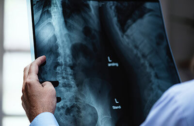 Interventional Radiology Coding Charts